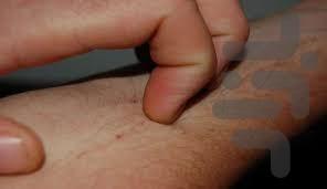 خارش پوست رو از بین ببر - Image screenshot of android app