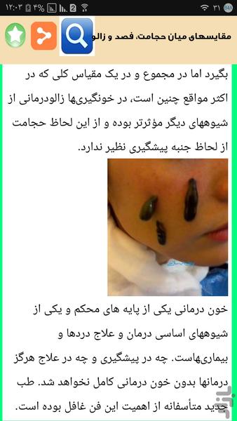 خواص عجیب زالو درمانی - Image screenshot of android app