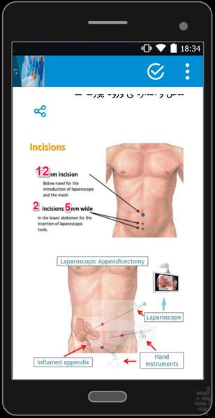 لاپاراسکوپی(مناسب برای دانشجویان) - Image screenshot of android app