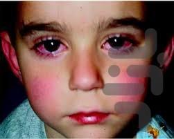 درمان اختلال مادرزاد - عکس برنامه موبایلی اندروید