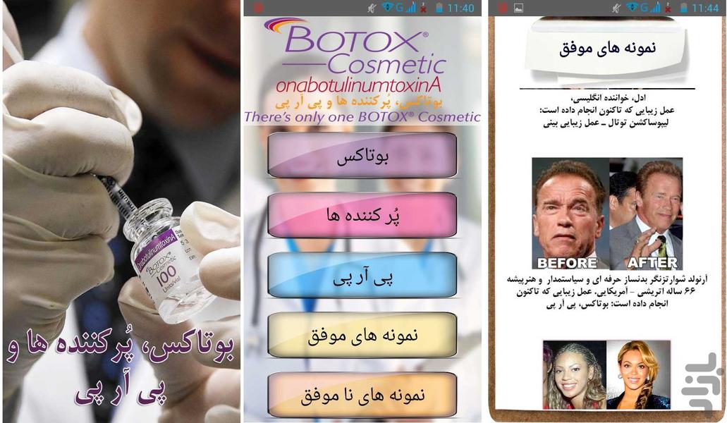 Botox, Filer, PRP - Image screenshot of android app