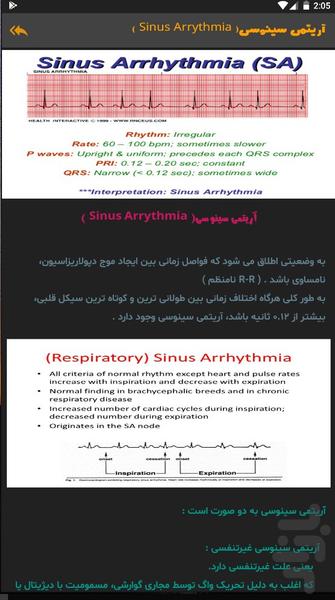 آریتمی قلبی - عکس برنامه موبایلی اندروید