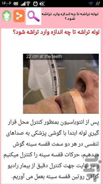 تکنیک ساکشن کردن بیمار - عکس برنامه موبایلی اندروید