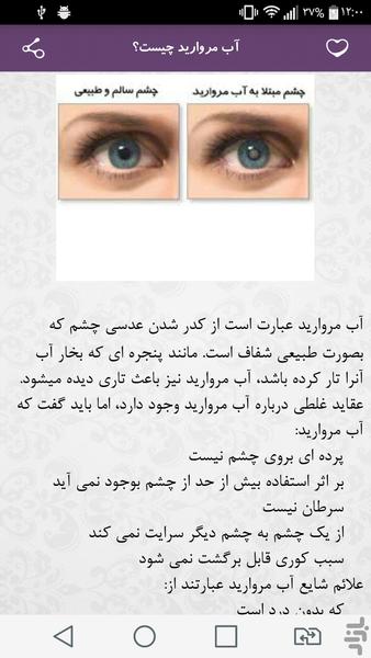 آب مروارید - Image screenshot of android app