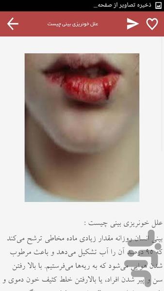 خون دماغ - عکس برنامه موبایلی اندروید