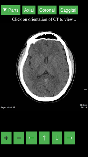 Radiology CT Viewer - عکس برنامه موبایلی اندروید
