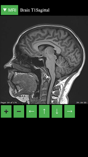 MRI Viewer - Image screenshot of android app