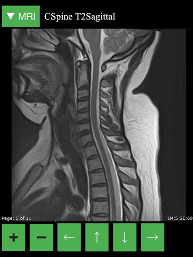 MRI Viewer - عکس برنامه موبایلی اندروید