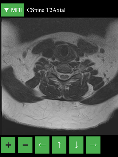 MRI Viewer - عکس برنامه موبایلی اندروید