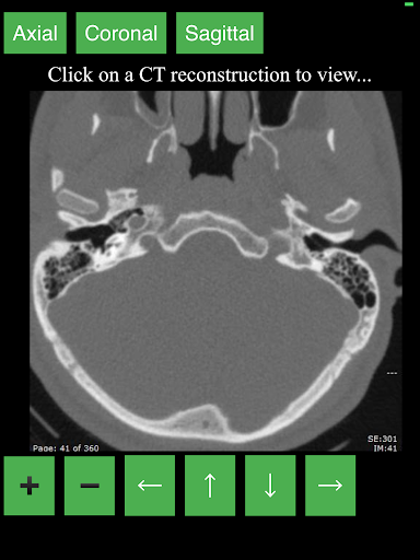 CT Cervical Spine - Image screenshot of android app