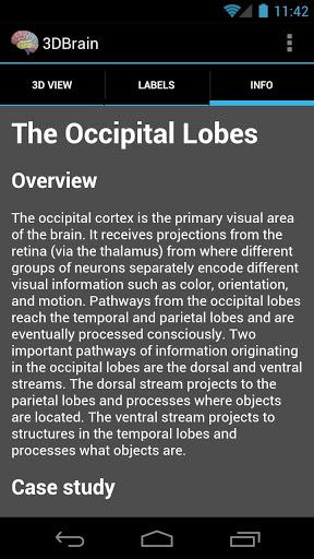 3DBrain - Image screenshot of android app