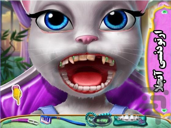 بازی ارتودنسی آنجلا - Gameplay image of android game