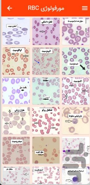 هماتولوژی کاربردی - عکس برنامه موبایلی اندروید