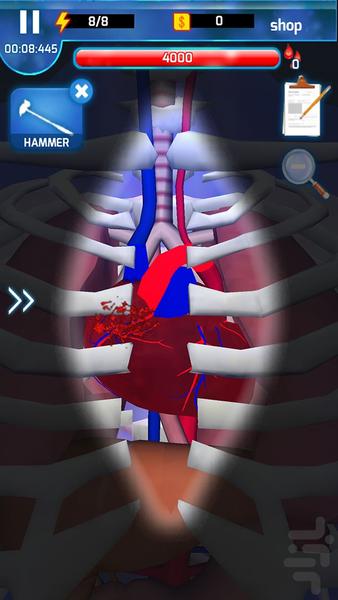 بازی جراحی قلب - Gameplay image of android game