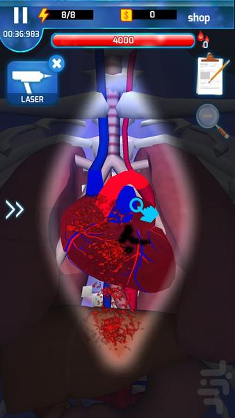 بازی جراحی قلب - Gameplay image of android game