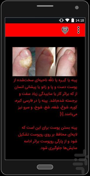 شایعترین بیماریهای پوستی+درمان - عکس برنامه موبایلی اندروید