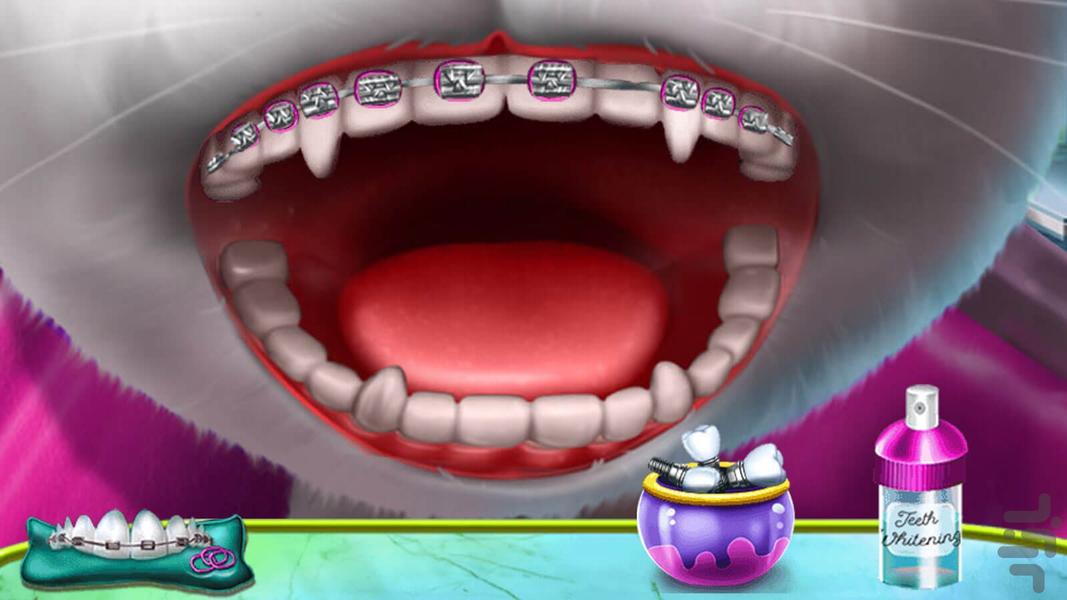 Angela's dental game - Gameplay image of android game