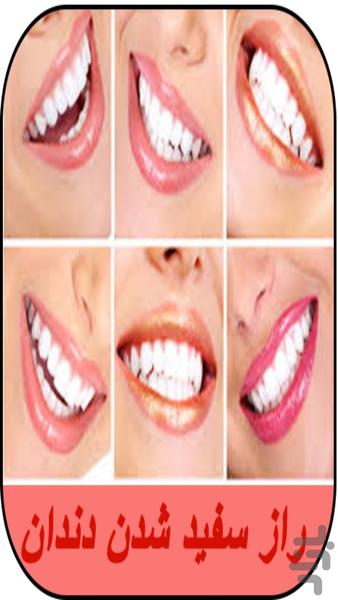 راز سفید شدن دندان - عکس برنامه موبایلی اندروید