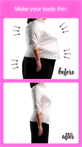 Rhinoplasty - Image screenshot of android app