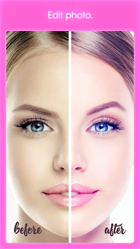 Rhinoplasty - Image screenshot of android app