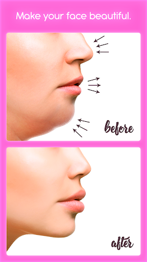 Rhinoplasty - Image screenshot of android app