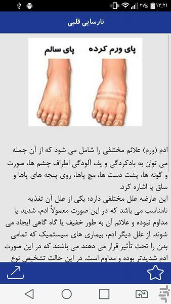 ادم و ورم بدن - Image screenshot of android app