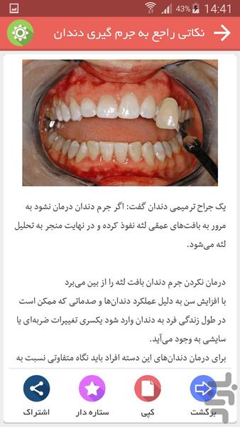سفید کردن دندان ها - عکس برنامه موبایلی اندروید