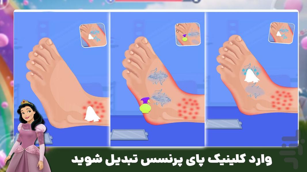 بازی مراقبت پا - Gameplay image of android game