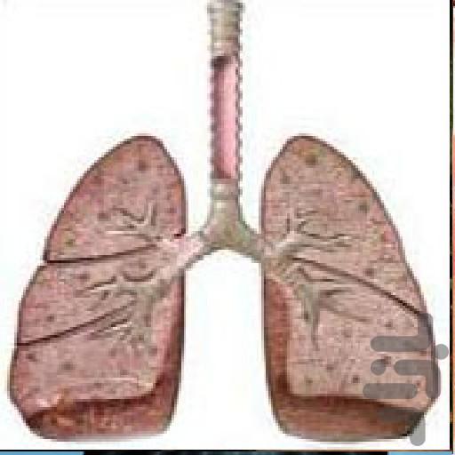 مشکلات تنفسی - Image screenshot of android app